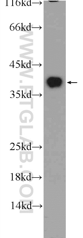 WB analysis of HepG2 using 25292-1-AP