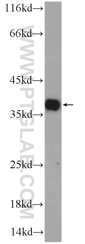 Western Blot (WB) analysis of A431 cells using EXOSC7 Polyclonal antibody (25292-1-AP)