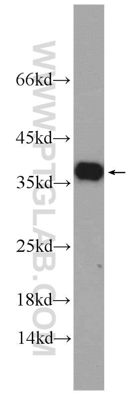 Western Blot (WB) analysis of COLO 320 cells using EXOSC7 Polyclonal antibody (25292-1-AP)