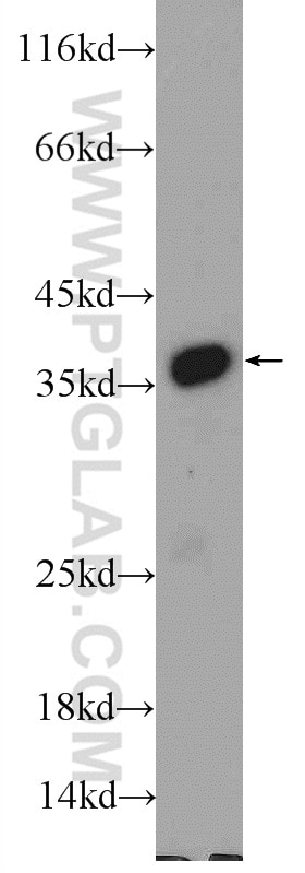 Western Blot (WB) analysis of HEK-293 cells using EXOSC7 Polyclonal antibody (25292-1-AP)