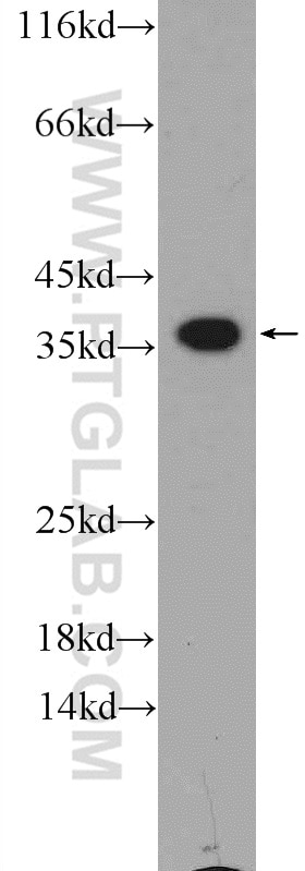 Western Blot (WB) analysis of Jurkat cells using EXOSC7 Polyclonal antibody (25292-1-AP)