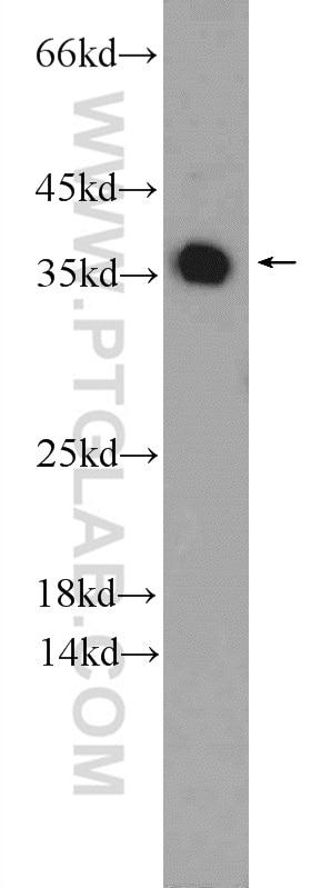 Western Blot (WB) analysis of HeLa cells using EXOSC7 Polyclonal antibody (25292-1-AP)