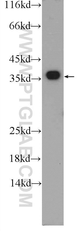 Western Blot (WB) analysis of MCF-7 cells using EXOSC7 Polyclonal antibody (25292-1-AP)