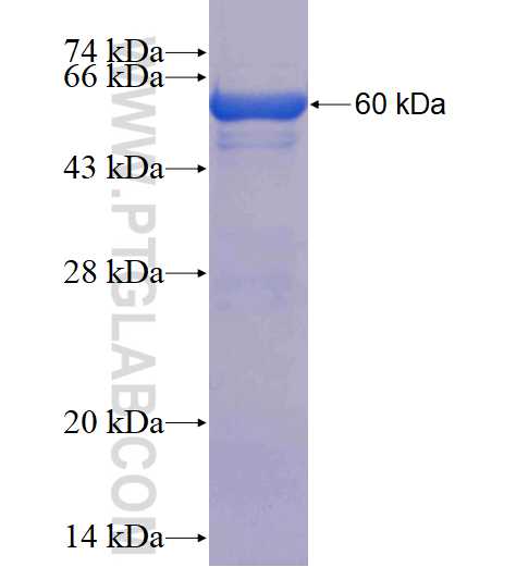 EXOSC7 fusion protein Ag18212 SDS-PAGE