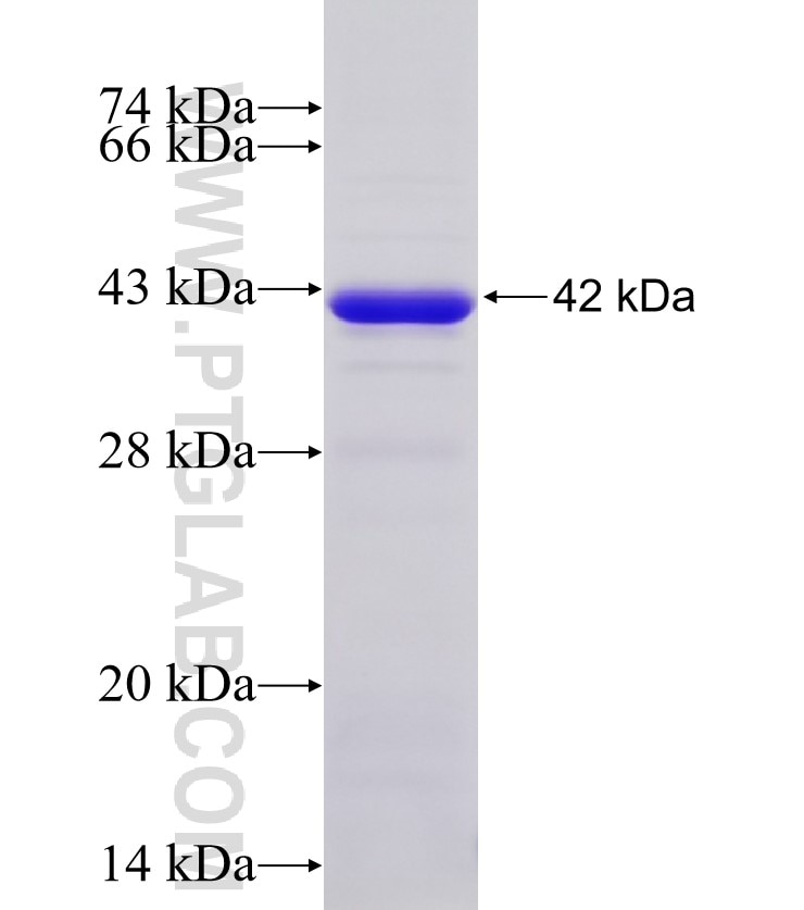 EXOSC7 fusion protein Ag18322 SDS-PAGE
