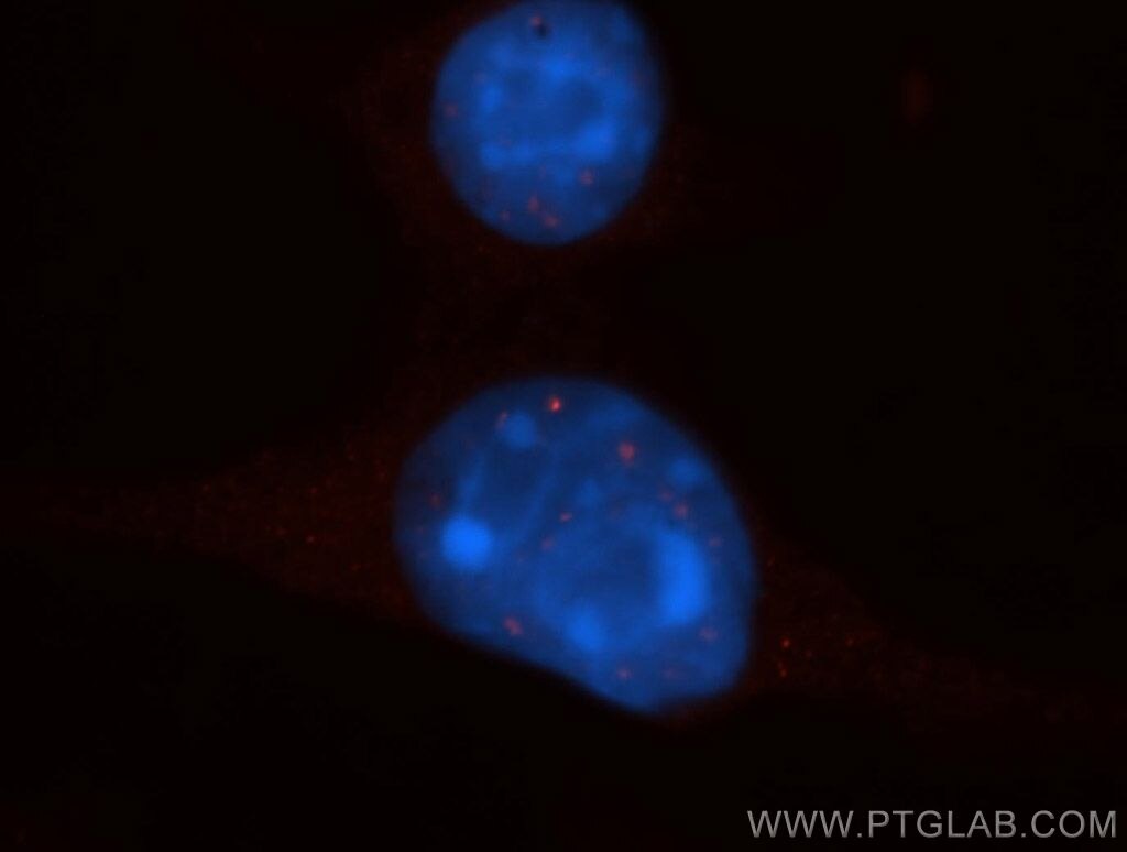 Immunofluorescence (IF) / fluorescent staining of 4T1 cells using EXOSC8 Polyclonal antibody (11979-1-AP)