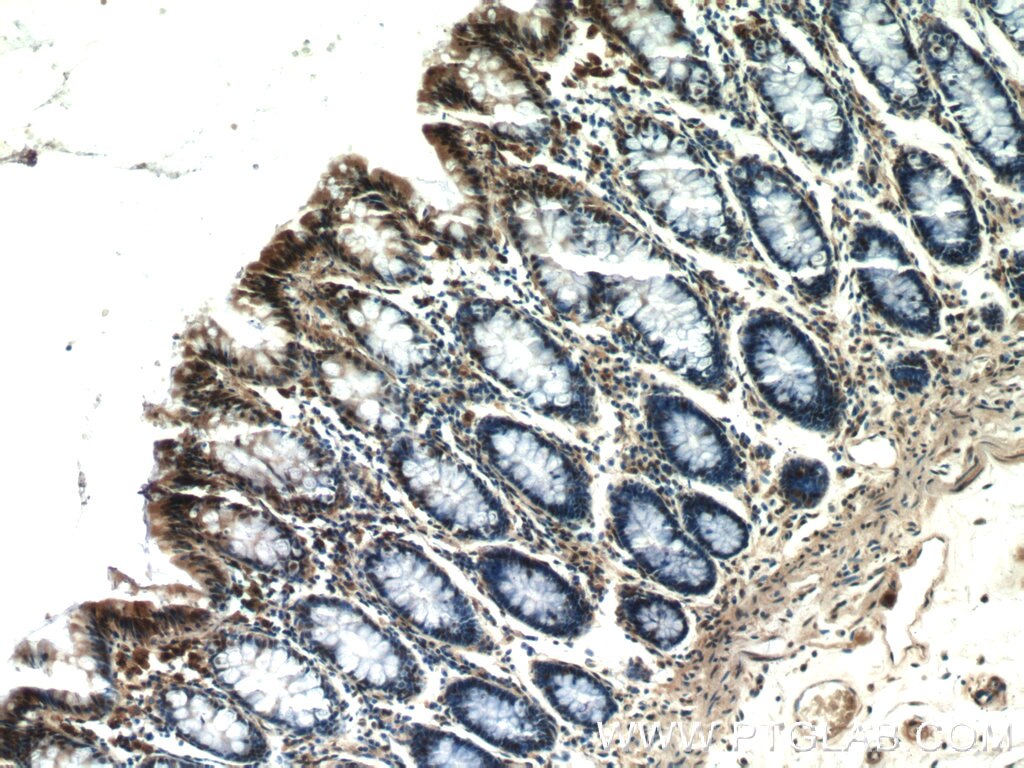 Immunohistochemistry (IHC) staining of human colon tissue using EXOSC8 Polyclonal antibody (11979-1-AP)