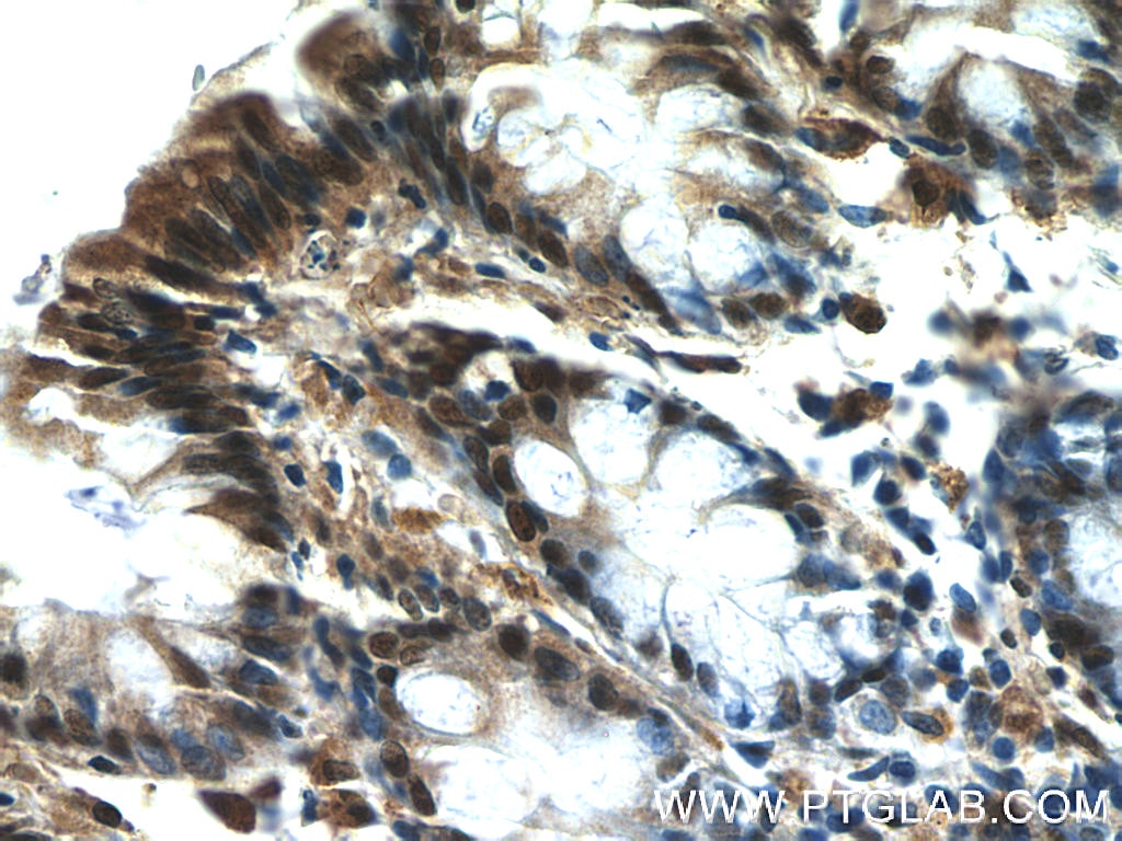 Immunohistochemistry (IHC) staining of human colon tissue using EXOSC8 Polyclonal antibody (11979-1-AP)