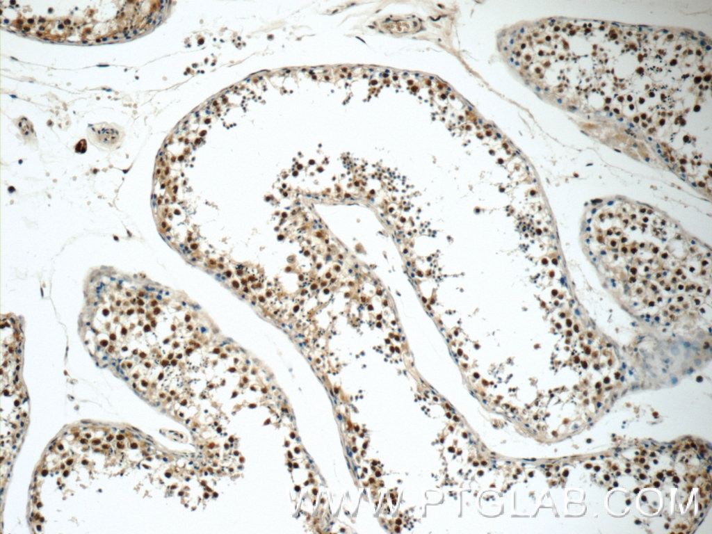 Immunohistochemistry (IHC) staining of human testis tissue using EXOSC8 Polyclonal antibody (11979-1-AP)