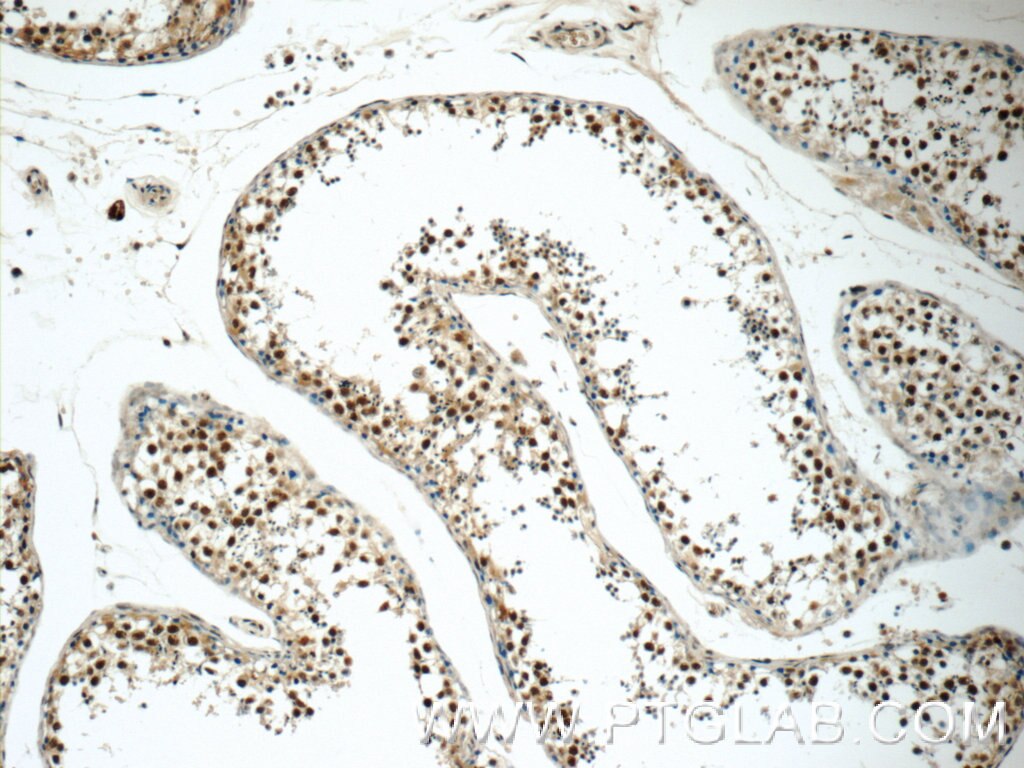 IHC staining of human testis using 11979-1-AP