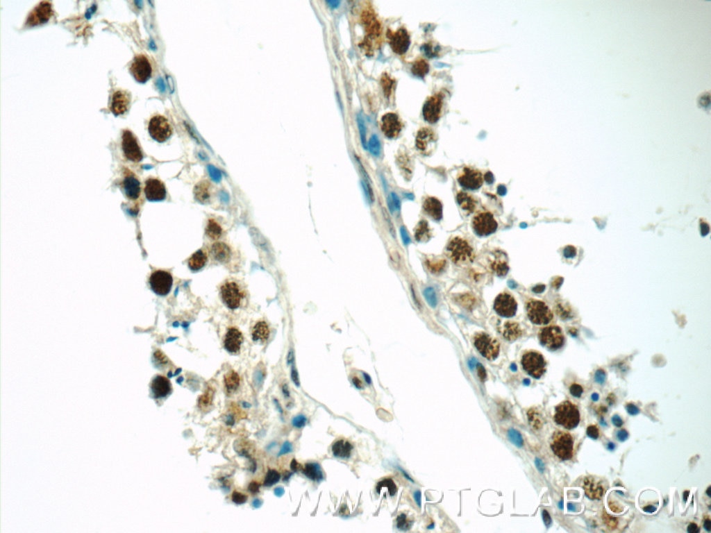 Immunohistochemistry (IHC) staining of human testis tissue using EXOSC8 Polyclonal antibody (11979-1-AP)