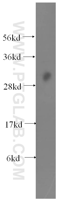 Western Blot (WB) analysis of human brain tissue using EXOSC8 Polyclonal antibody (11979-1-AP)