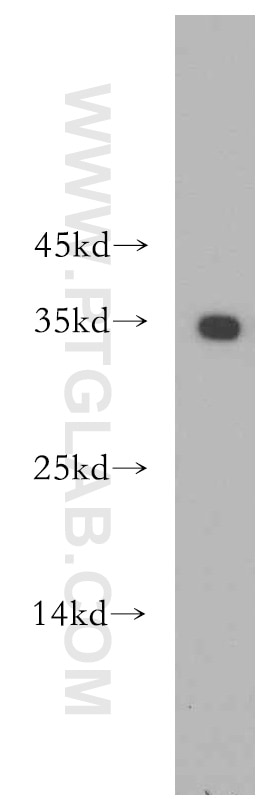 Western Blot (WB) analysis of HeLa cells using EXOSC8 Polyclonal antibody (11979-1-AP)