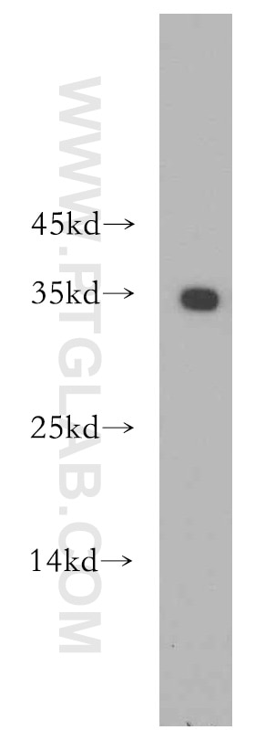 WB analysis of HeLa using 11979-1-AP