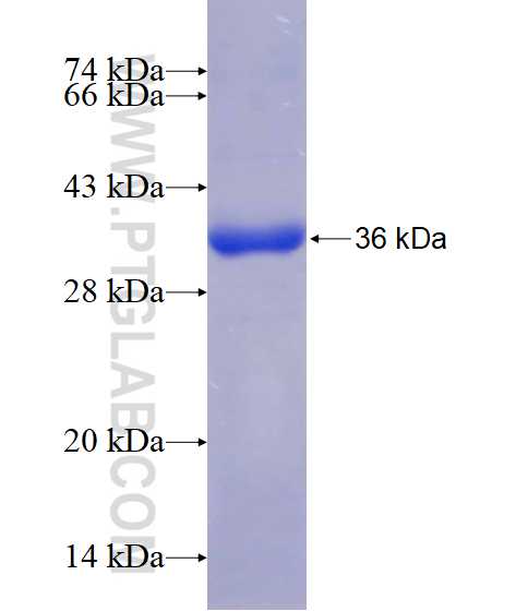 EXOSC8 fusion protein Ag17516 SDS-PAGE