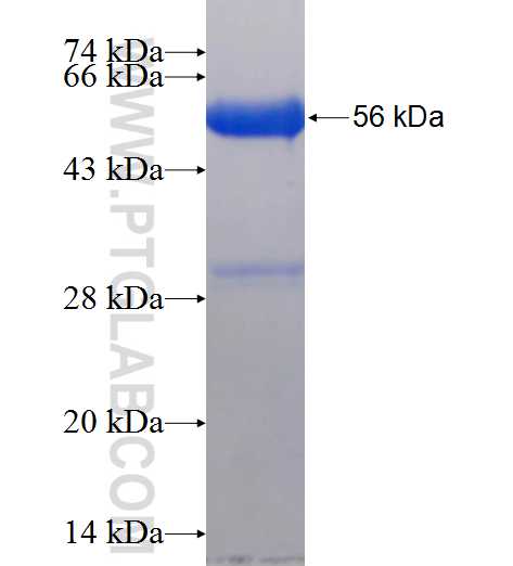 EXOSC8 fusion protein Ag2605 SDS-PAGE