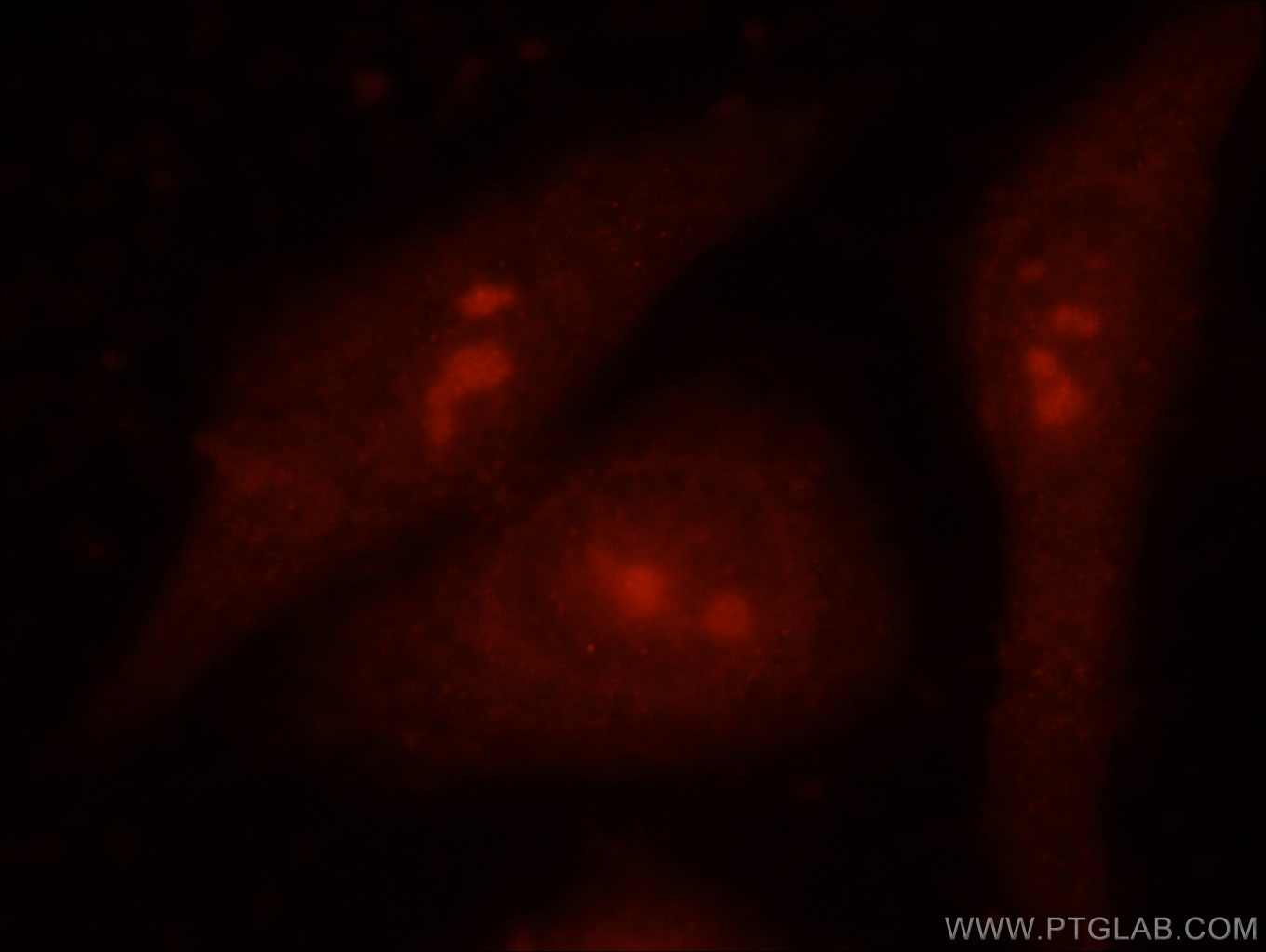 Immunofluorescence (IF) / fluorescent staining of HeLa cells using EXOSC9 Polyclonal antibody (24470-1-AP)