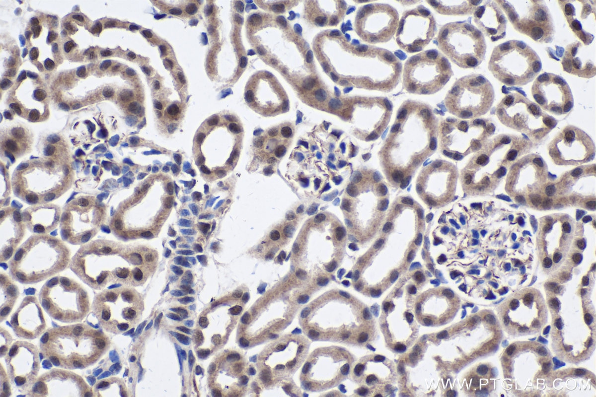 Immunohistochemistry (IHC) staining of mouse kidney tissue using EXOSC9 Polyclonal antibody (24470-1-AP)