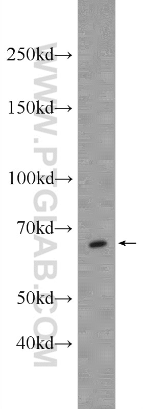 Western Blot (WB) analysis of MCF-7 cells using EXOSC9 Polyclonal antibody (24470-1-AP)