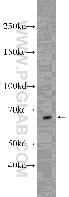 WB analysis of MCF-7 using 24470-1-AP