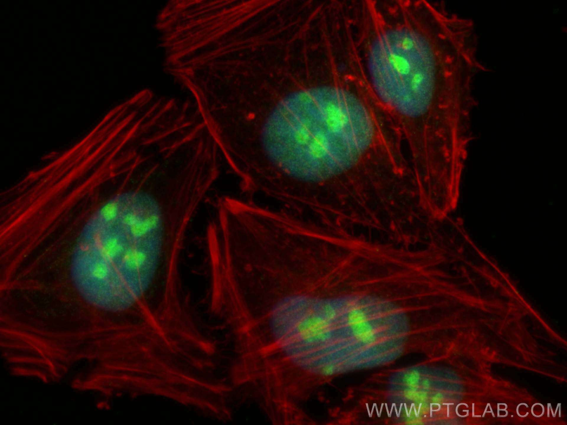 Immunofluorescence (IF) / fluorescent staining of HeLa cells using EXOSC9 Monoclonal antibody (67636-1-Ig)