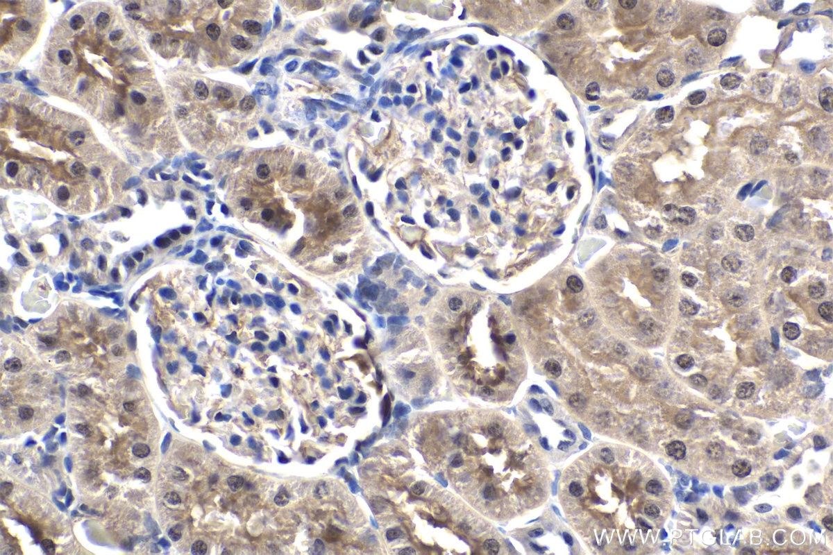 Immunohistochemistry (IHC) staining of rat kidney tissue using EXOSC9 Monoclonal antibody (67636-1-Ig)