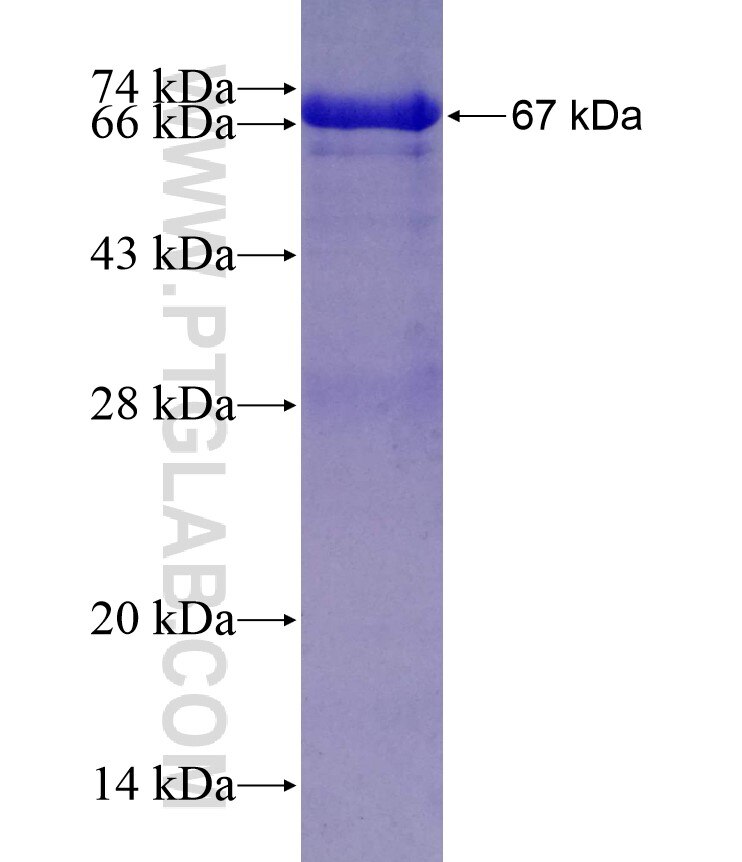 EXOSC9 fusion protein Ag19768 SDS-PAGE