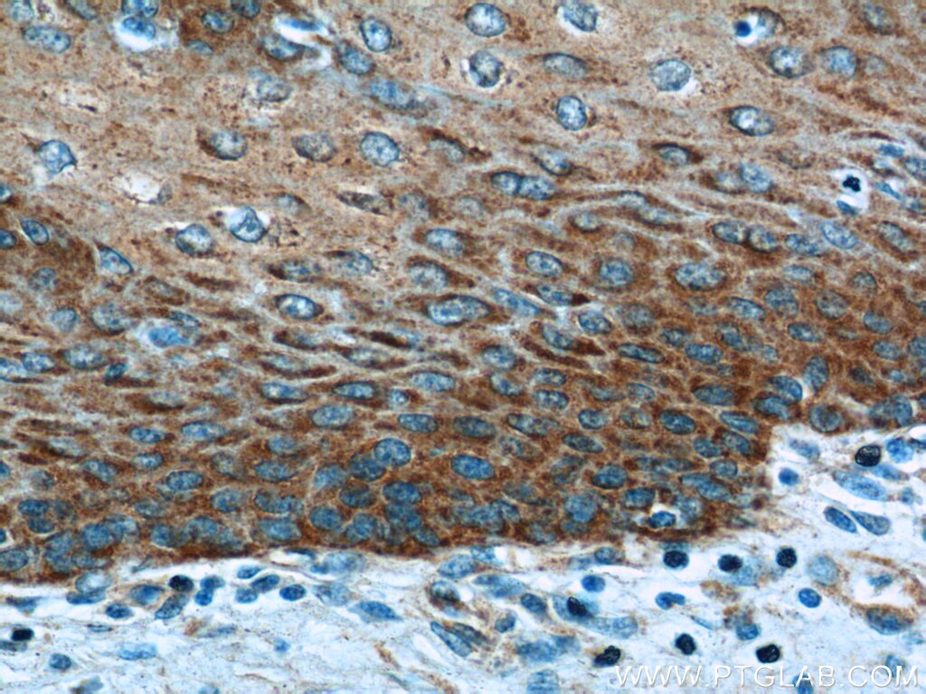 EXPH5 Polyclonal antibody