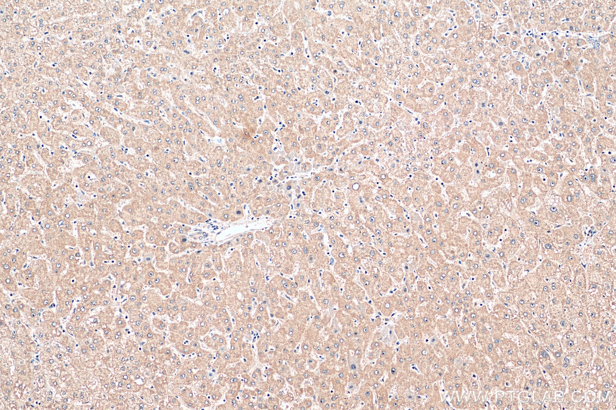 Immunohistochemistry (IHC) staining of human liver tissue using EXPH5 Polyclonal antibody (22199-1-AP)