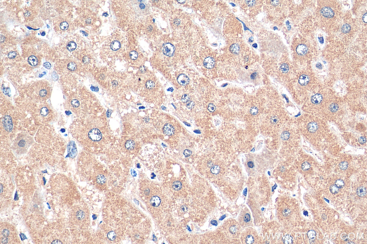 Immunohistochemistry (IHC) staining of human liver tissue using EXPH5 Polyclonal antibody (22199-1-AP)