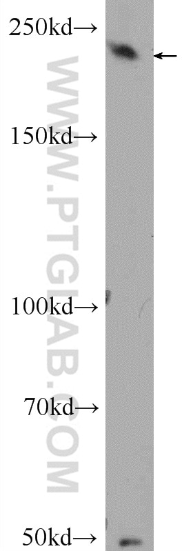 Western Blot (WB) analysis of A431 cells using EXPH5 Polyclonal antibody (22199-1-AP)