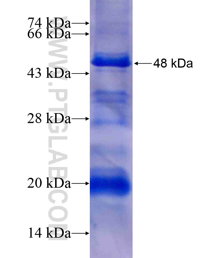 EXPH5 fusion protein Ag17449 SDS-PAGE