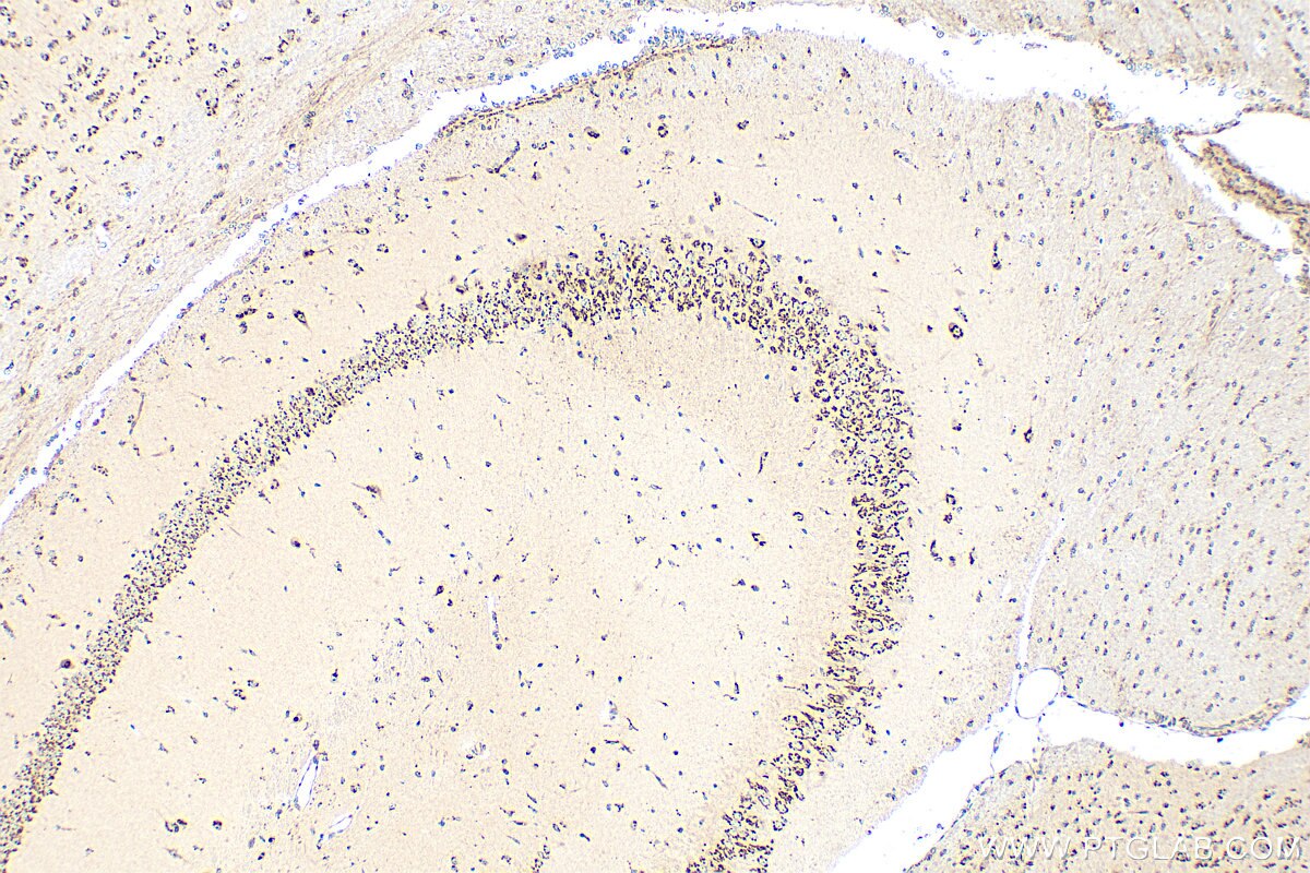 Immunohistochemistry (IHC) staining of mouse brain tissue using EXTL2 Polyclonal antibody (12828-1-AP)
