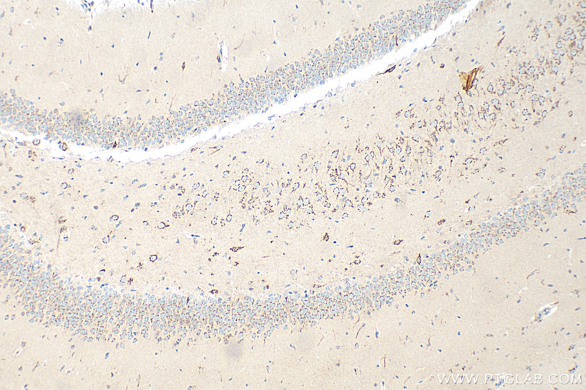 Immunohistochemistry (IHC) staining of rat brain tissue using EXTL2 Polyclonal antibody (12828-1-AP)