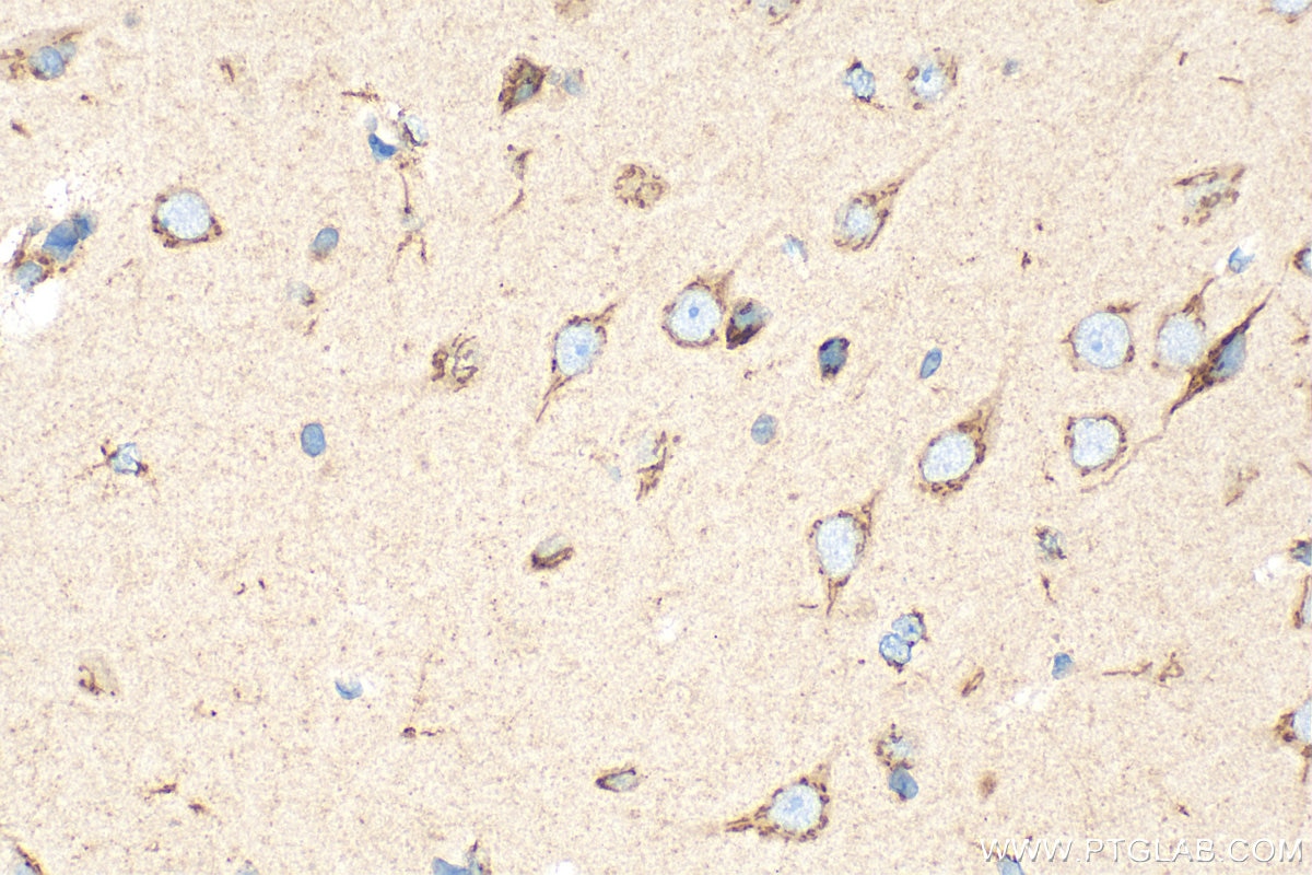 Immunohistochemistry (IHC) staining of rat brain tissue using EXTL2 Polyclonal antibody (12828-1-AP)