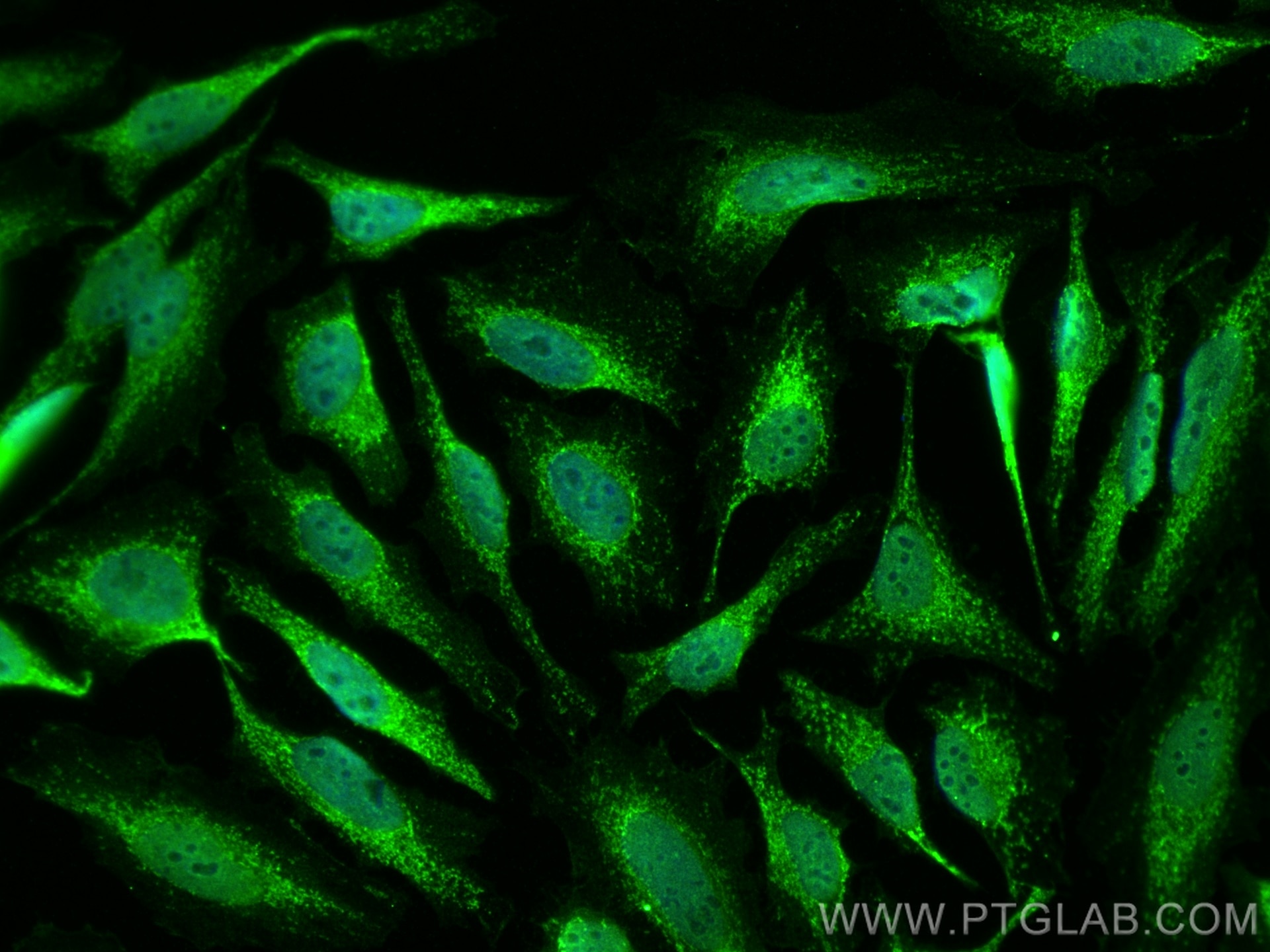 Immunofluorescence (IF) / fluorescent staining of HeLa cells using EYA1 Polyclonal antibody (22658-1-AP)