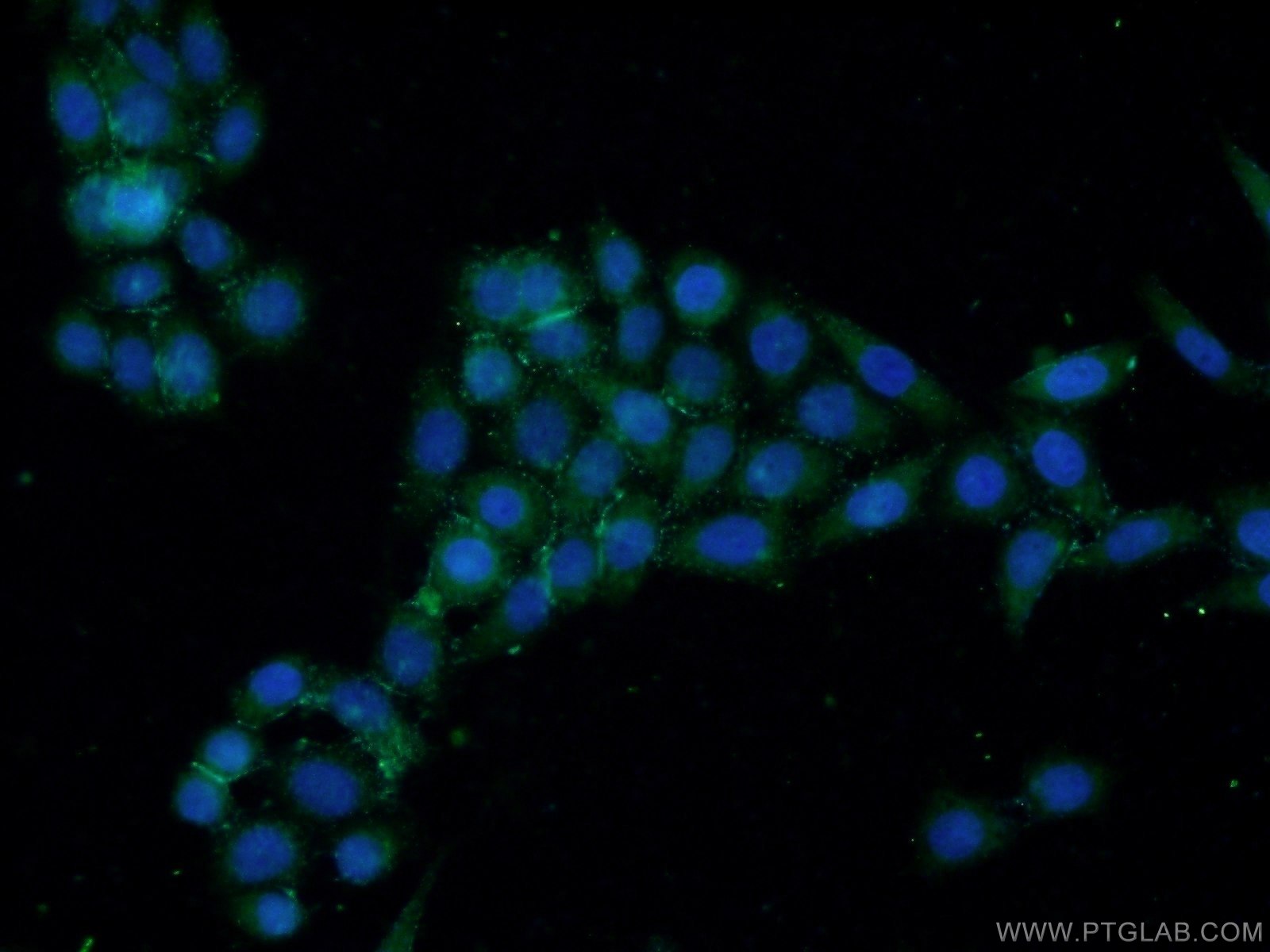 Immunofluorescence (IF) / fluorescent staining of HeLa cells using EYA1 Polyclonal antibody (22658-1-AP)