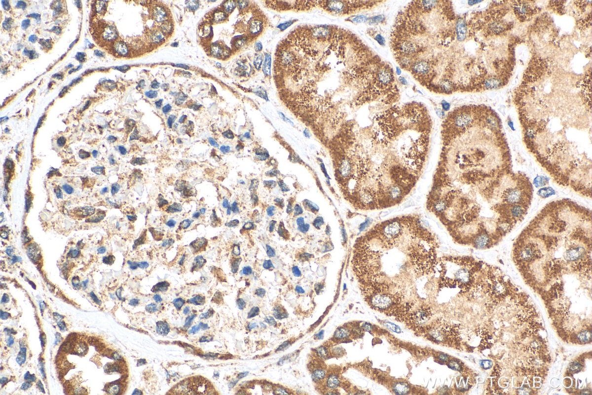 Immunohistochemistry (IHC) staining of human kidney tissue using EYA1 Polyclonal antibody (22658-1-AP)