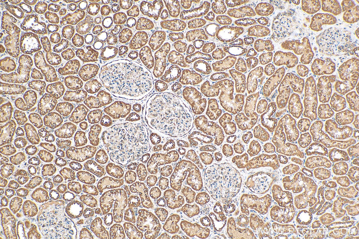 Immunohistochemistry (IHC) staining of human kidney tissue using EYA1 Polyclonal antibody (22658-1-AP)