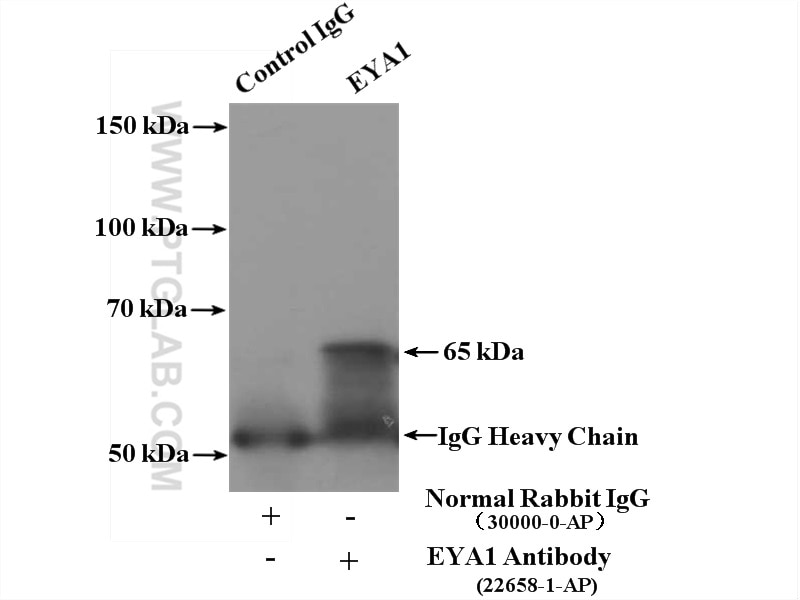 Immunoprecipitation (IP) experiment of mouse kidney tissue using EYA1 Polyclonal antibody (22658-1-AP)