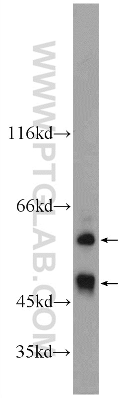 Western Blot (WB) analysis of mouse kidney tissue using EYA1 Polyclonal antibody (22658-1-AP)