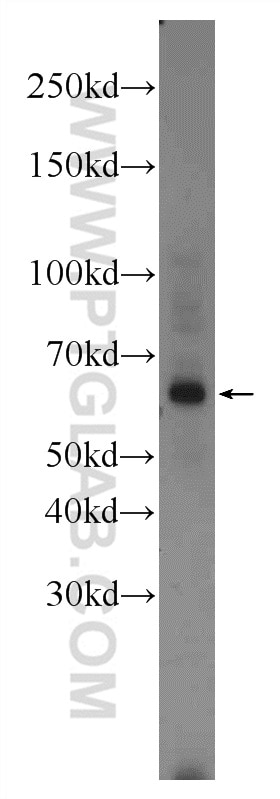 Western Blot (WB) analysis of mouse colon tissue using EYA1 Polyclonal antibody (22658-1-AP)
