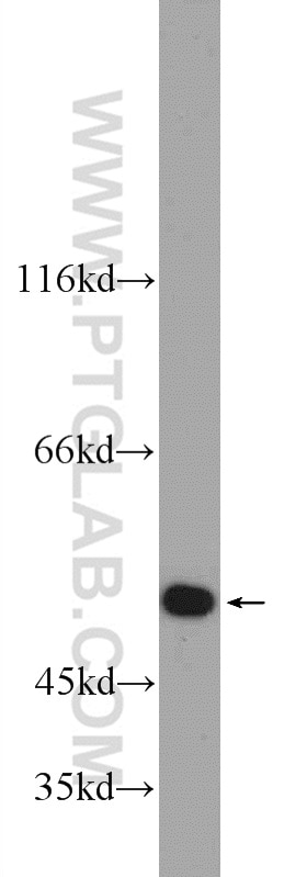 Western Blot (WB) analysis of HeLa cells using EYA1 Polyclonal antibody (22658-1-AP)