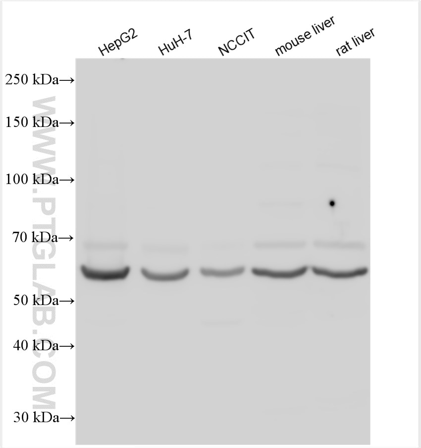 Western Blot (WB) analysis of various lysates using EYA1 Polyclonal antibody (22658-1-AP)