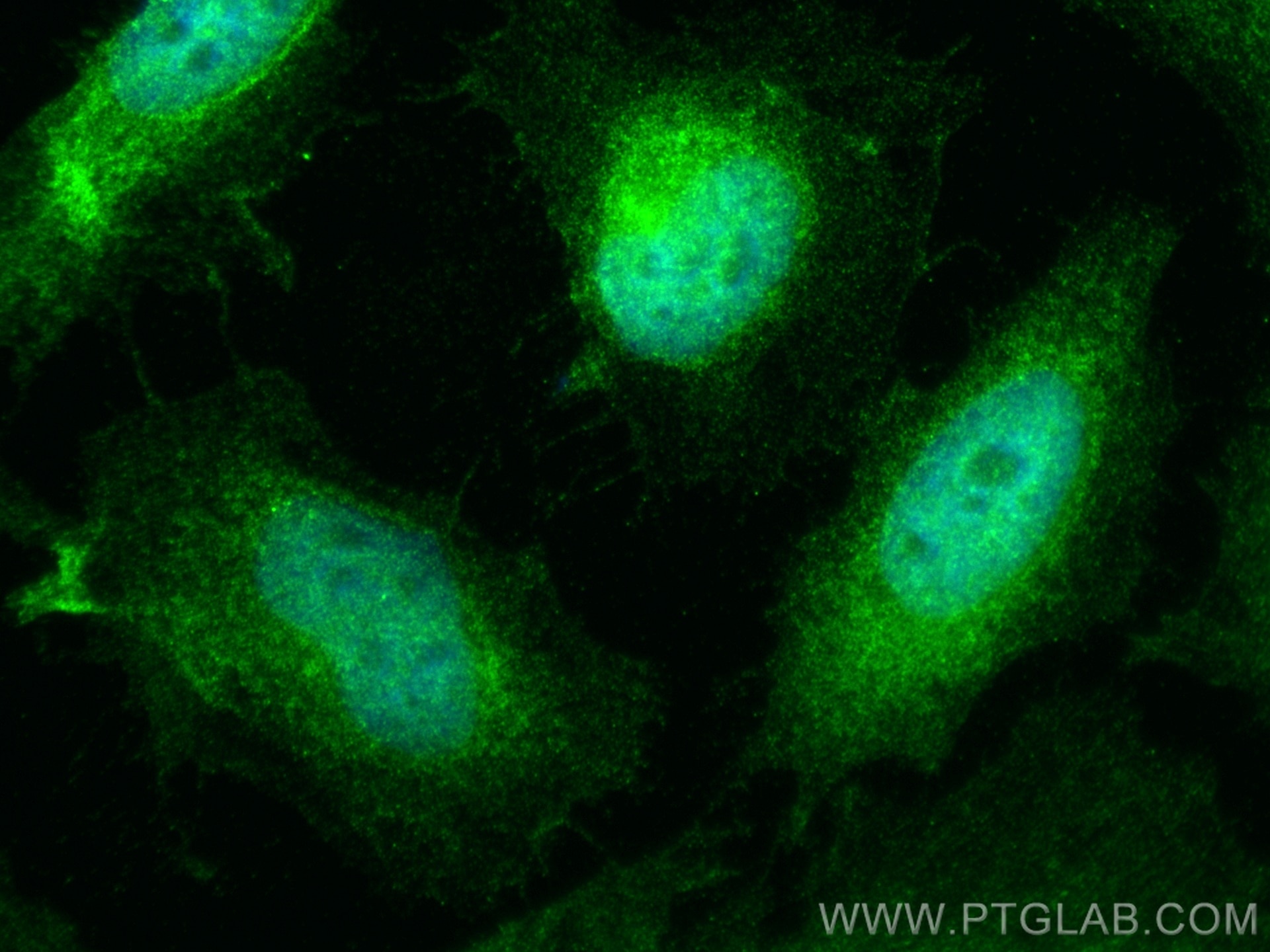 Immunofluorescence (IF) / fluorescent staining of HeLa cells using EYA2 Polyclonal antibody (11314-1-AP)