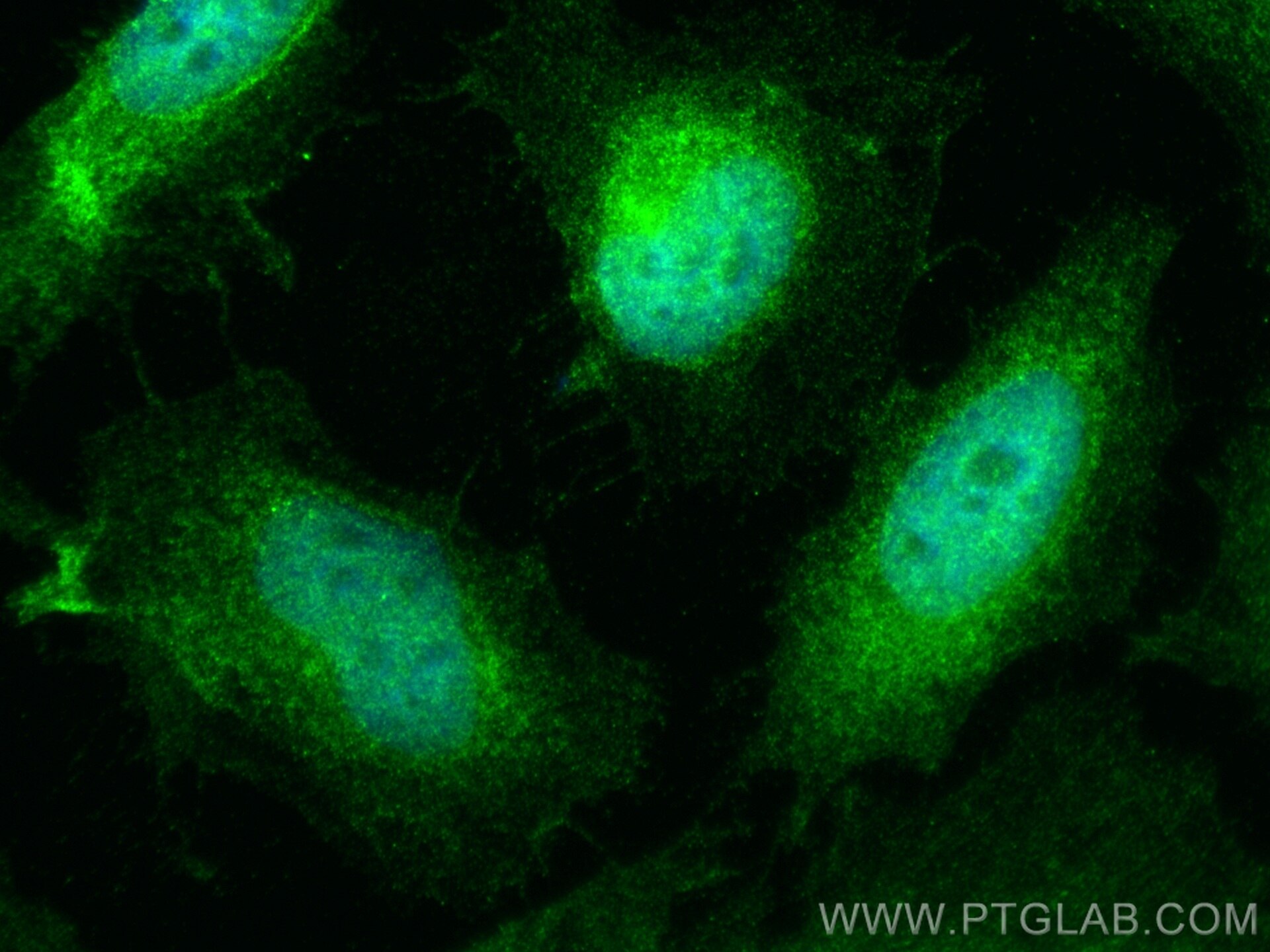 Immunofluorescence (IF) / fluorescent staining of HeLa cells using EYA2 Polyclonal antibody (11314-1-AP)