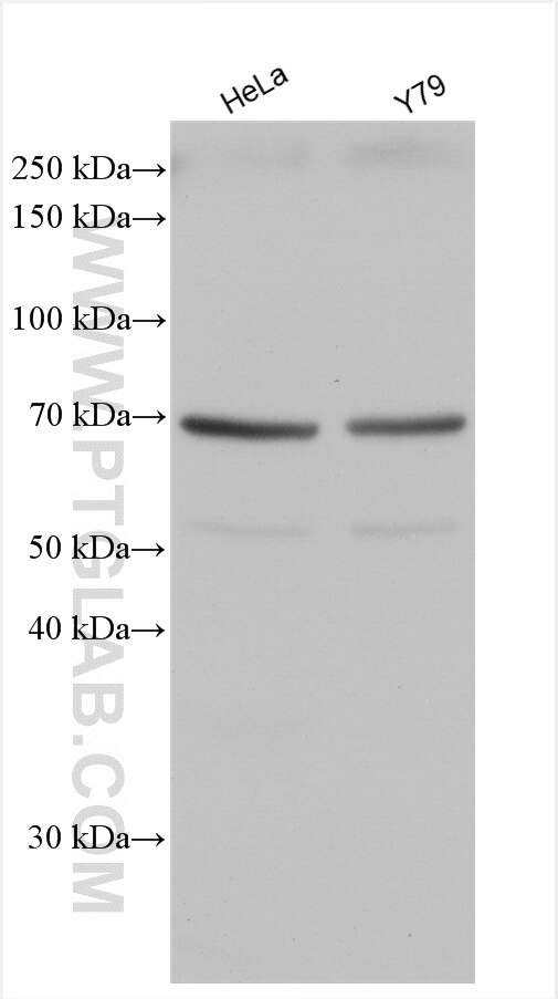 Western Blot (WB) analysis of various lysates using EYA2 Polyclonal antibody (11314-1-AP)