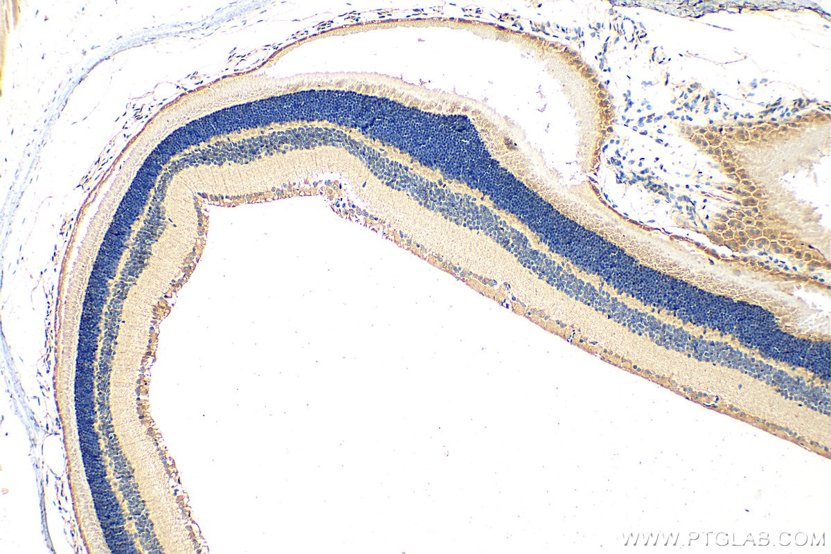 IHC staining of mouse eye using 30607-1-AP