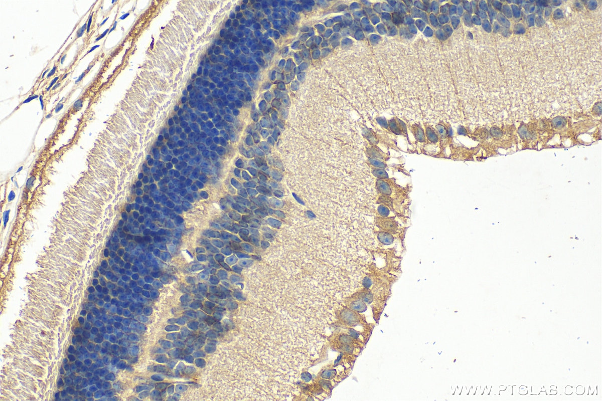 IHC staining of mouse eye using 30607-1-AP