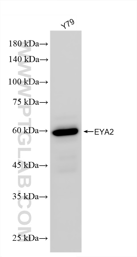 WB analysis of Y79 using 86046-2-RR (same clone as 86046-2-PBS) Western Blot (WB) analysis of Y79 cells using EYA2 Recombinant monoclonal antibody (86046-2-RR)